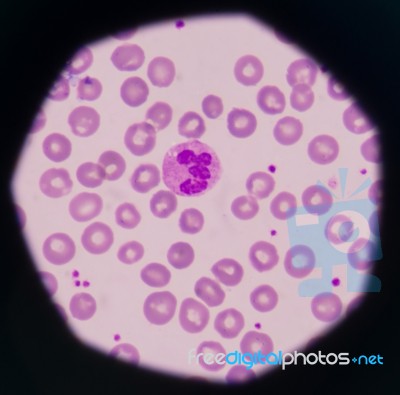 White Blood Cells Stock Photo