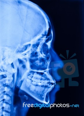 X-ray Stock Photo