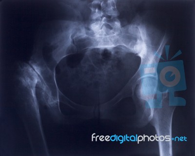 X-ray Stock Photo