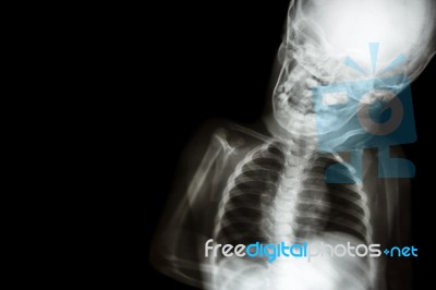 X-ray Body Of Child And Blank Area At Left Side Stock Photo