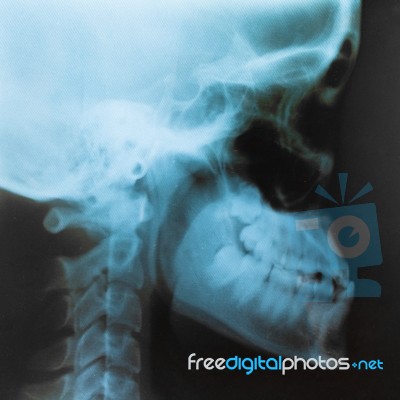 X-Ray Film Stock Photo