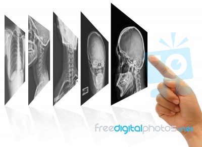 X Ray Films Stock Photo