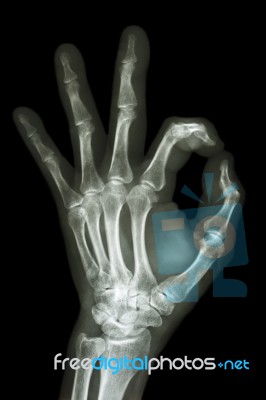 X-ray Hand With Ok Symbol Stock Photo