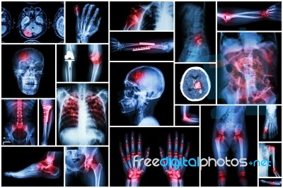 X-ray Multiple Disease Stock Photo