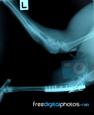 X Ray Picture Of Wild Animal Stock Photo