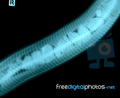 X Ray Picture Of Wild Animal Stock Photo