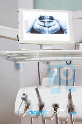 X-ray Teeth For Check Stock Photo