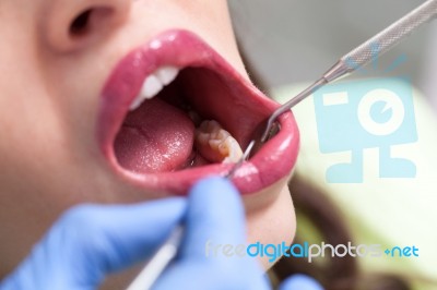 Young Girl Having Dental Check Up Stock Photo