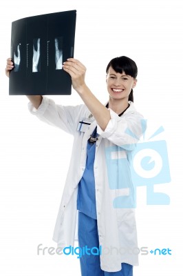 Young Surgeon Holding X-ray Sheet Of A Patient Stock Photo