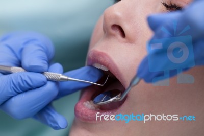 Young Woman At The Dental Office Stock Photo