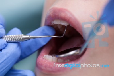 Young Woman At The Dental Office Stock Photo