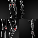 3d Rendering Illustration Of The  Patella Bone Stock Photo