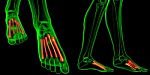 3d Rendering Medical Illustration Of The Metatarsal Bones Stock Photo