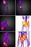 3d Rendering  Medical Illustration Of The Pelvis Bone Stock Photo