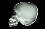 Asian Child's Skull (thai People) Stock Photo