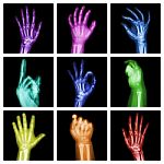 Collection Of Colorful X-ray Hands Stock Photo