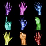 Collection Of Colorful X-ray Hands Stock Photo