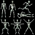 Collection Of Human Skeleton (x-ray Whole Body : Skull Head Face Neck Spine Shoulder Arm Forearm Elbow Wrist Hand Finger Thorax Lung Heart Abdomen Pelvis Leg Knee Joint Thigh Foot Ankle Heel ) Stock Photo