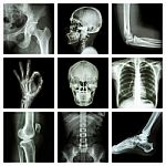 Collection X-ray Part Of Human Stock Photo