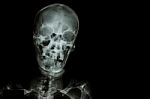 Film X-ray Skull And Blank Area At Right Side Stock Photo