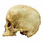 Human Skull Fracture (side)  (mongoloid,asian) On Isolated Background Stock Photo