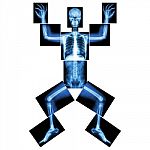 Jigsaw Human X-ray ( Whole Body : Head Skull Face Neck Spine Shoulder Arm Elbow Joint Forearm Wrist Hand Finger Chest Thorax Heart Lung Rib Abdomen Back Pelvis Hip Thigh Knee Leg Ankle Foot Heel Toe ) Stock Photo