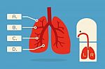 Lung Infographics Stock Photo