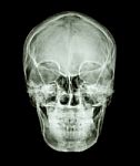 Normal Asian Human's Skull (thai People) Stock Photo