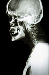 Normal Human's Skull And Cervical Spine Stock Photo