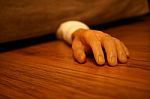 Severed Arm Stock Photo