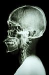 X-ray Asian Skull And Cervical Spine Stock Photo