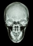 X-ray Asian Skull (thai People) Stock Photo