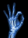 X-ray Hand With Ok Symbol Stock Photo