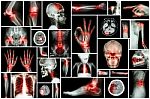 X-ray Multiple Part Of Human With Multiple Disease (stroke, Arthritis, Gout, Rheumatoid, Brain Tumor, Osteoarthritis, Etc) Stock Photo