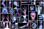 X-ray Multiple Part Of Human With Multiple Disease (stroke, Arthritis, Gout, Rheumatoid, Brain Tumor, Osteoarthritis, Etc) Stock Photo