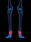 X-Ray Of Human Ankle Stock Photo