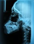 X-ray Skull Stock Photo